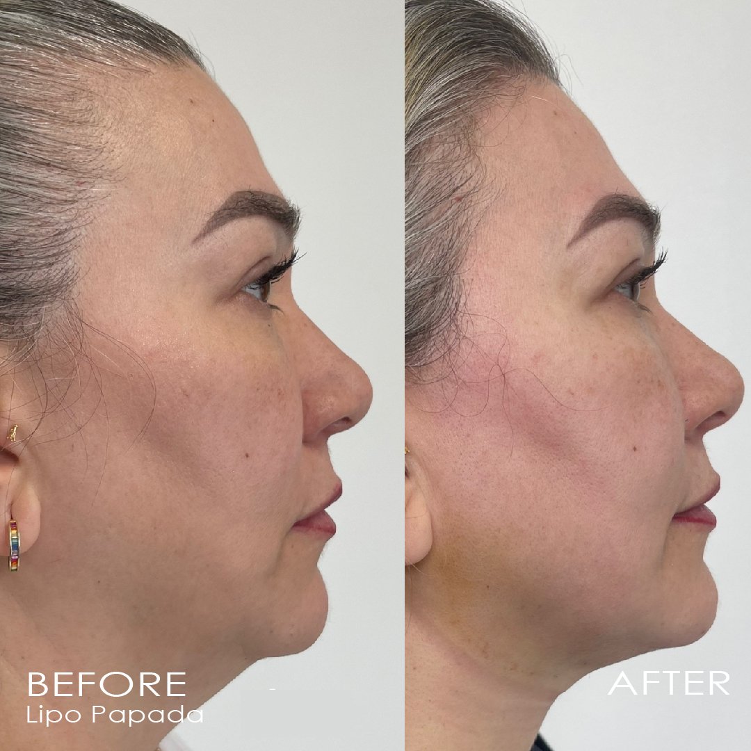 BEFORE-AND-AFTER-06